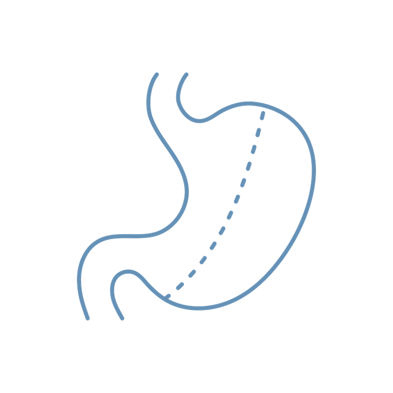 gastricsleeve