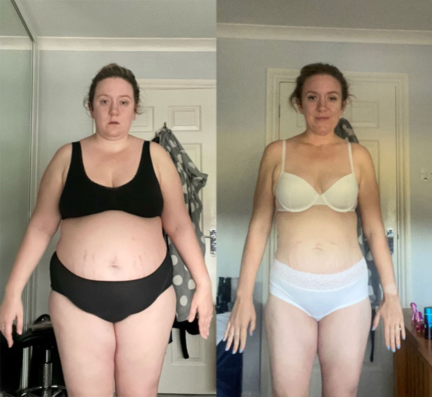 Woman’s body photo before gastric sleeve surgery