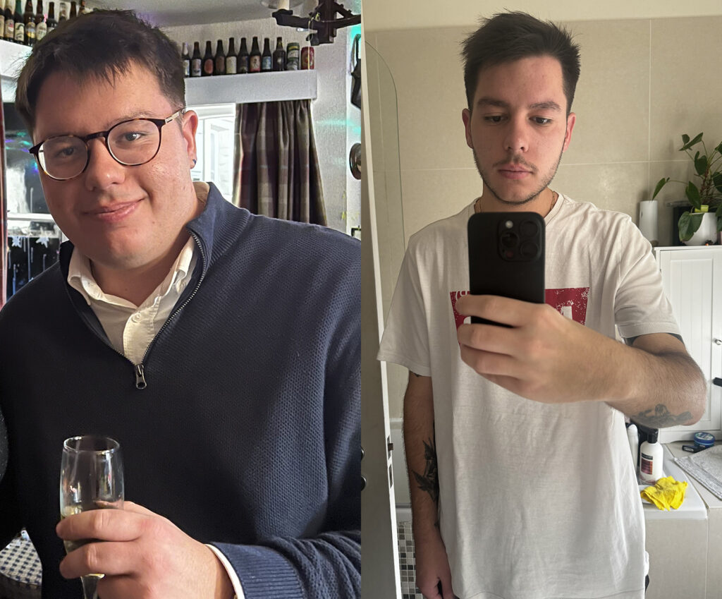 Man's Gastric Bypass Before and After Photos