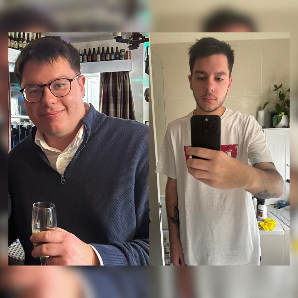 Man's Gastric Bypass Before and After Photos