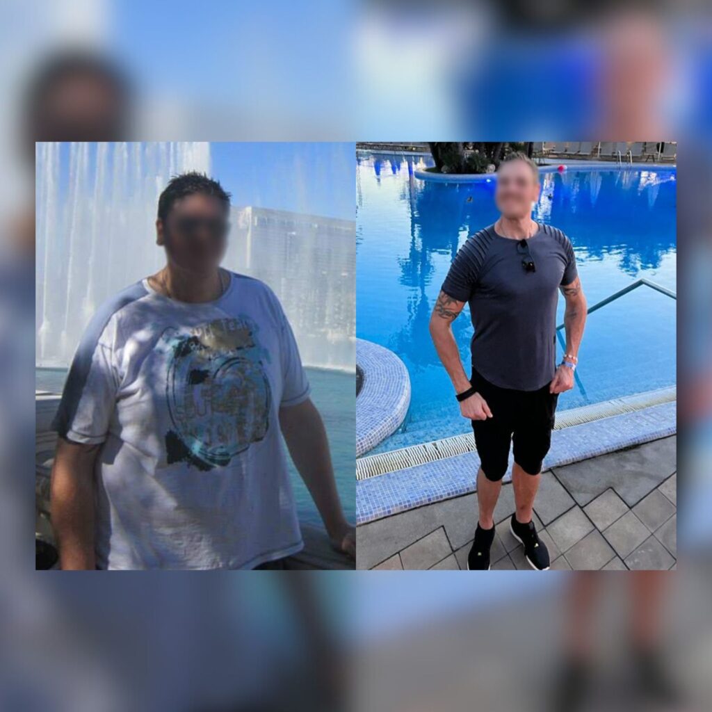 Male body transformation following gastric sleeve surgery
