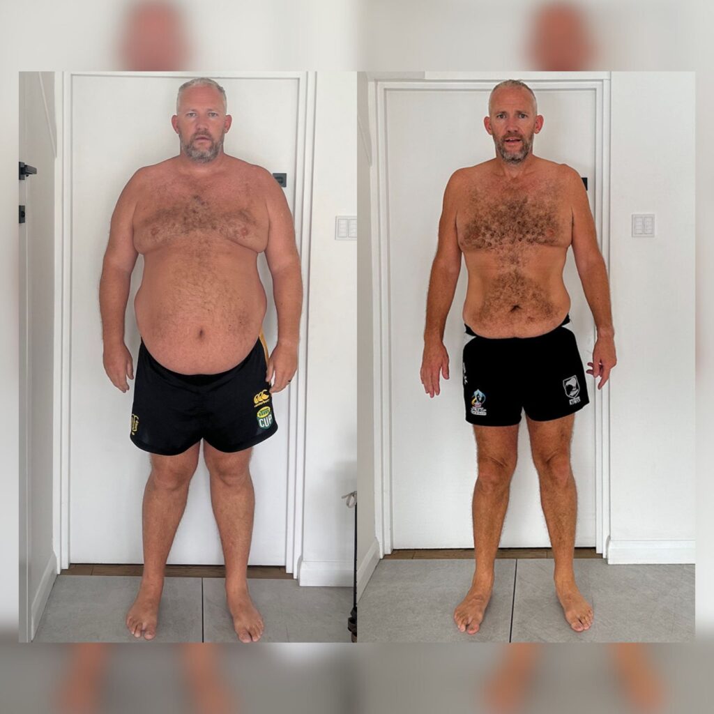 Man showing dramatic weight reduction post gastric sleeve