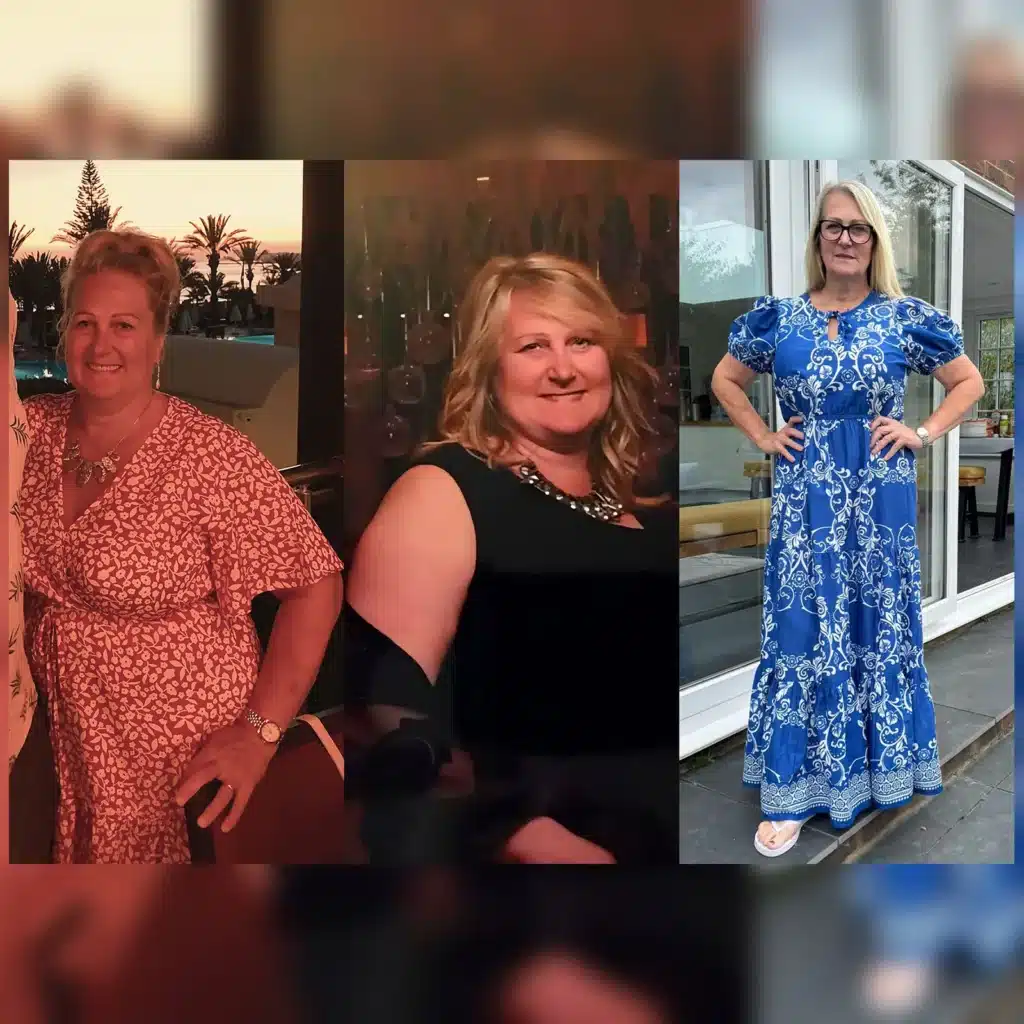 Successful gastric sleeve surgery results with visible weight change